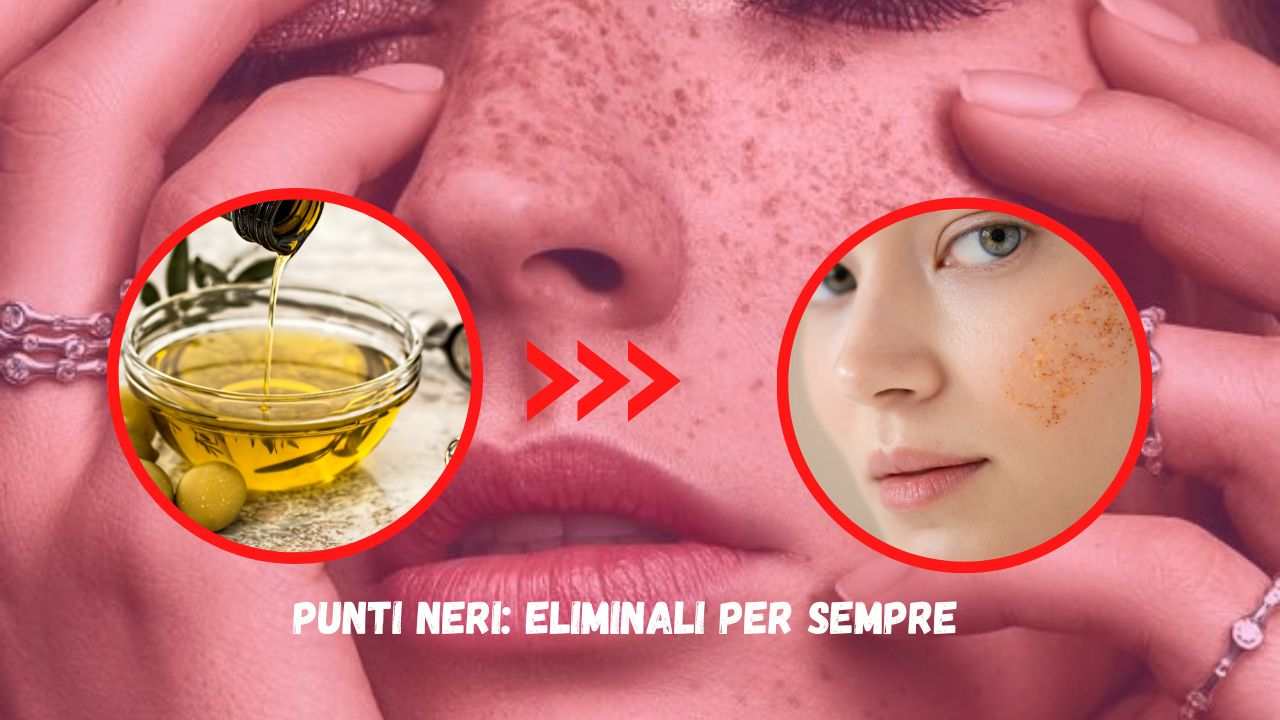 punti neri