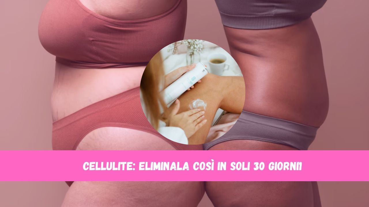 cellulite