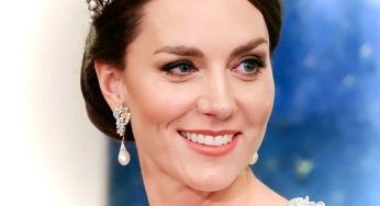 Creme “botox like”: cosa sono i cosmetici molto apprezzati da Kate Middleton